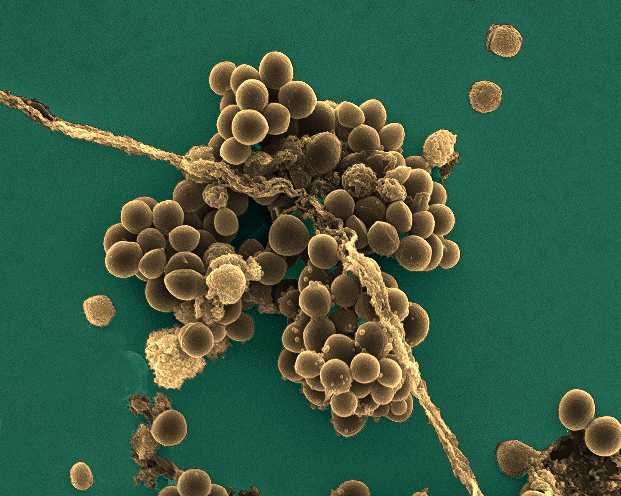 Staphylococcus aureus: a new mechanism involved in virulence and antibiotic  resistance - News from the Institut Pasteur
