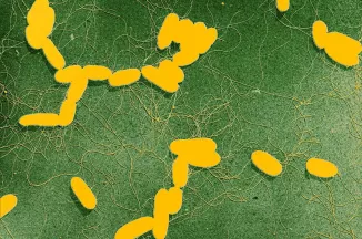 Salmonella - Institut Pasteur