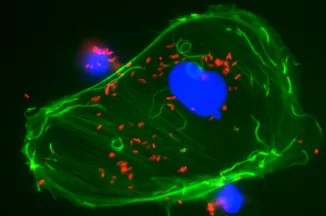 Observation en microscopie à fluorescence d'une cellules infectée par Listeria ©  Institut Pasteur/Edith Gouin et Pascale Cossart