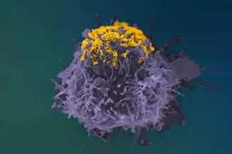 Accumulation de particules de VIH à la surface d’une cellule infectée