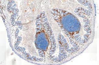 Gut microbes help set the body’s response to vaccination 