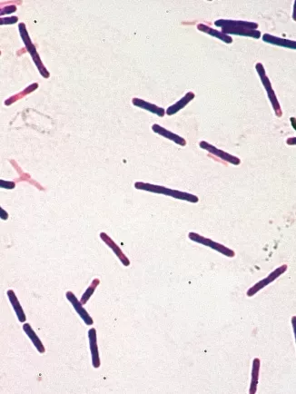 Fiche Maladie - Botulisme - Institut Pasteur