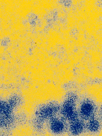 Fiches maladies - Fièvre jaune - Institut Pasteur