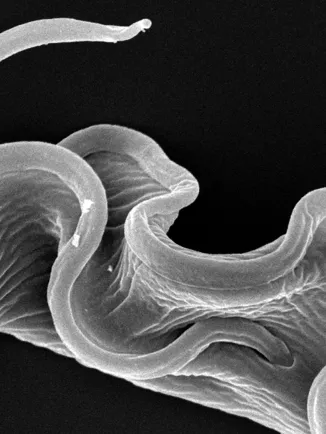 Fiches maladies - Maladie du sommeil - Institut Pasteur