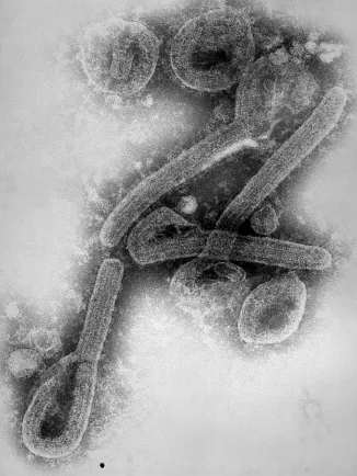 Image de microscopie électronique à transmission révélant une partie de la morphologie ultrastructurale présentée par un certain nombre de virions du virus Marburg