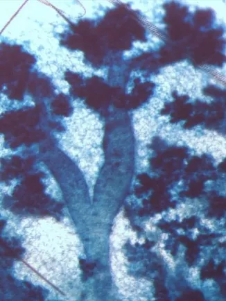 Morphologie d’une glande mammaire de souris