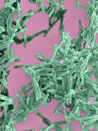 Mycobacterium tuberculosis, agent de la tuberculose. Microscopie electronique à balayage colorisée.