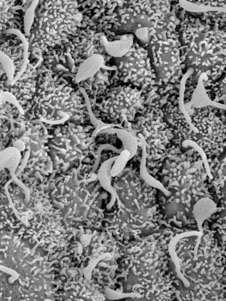 Cellules ciliées dans le noeud d'une souris mutante, vues par microscopie électronique à balayage. Ce modèle avec des cils paralysés permet de mieux comprendre comment le cœur se forme et reconnaît la droite et la gauche.