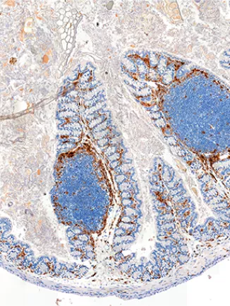 Gut microbes help set the body’s response to vaccination 