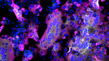 Microscopie à fluorescence de cellules infectées par le virus SARS-CoV-2