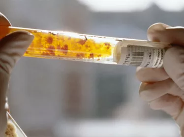 Pourquoi nous soutenir - Institut Pasteur
