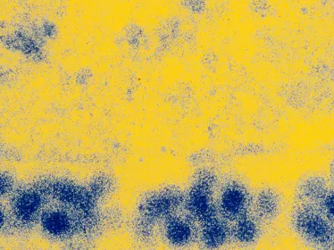 Fiches maladies - Fièvre jaune - Institut Pasteur
