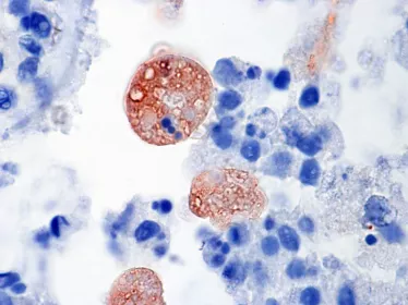 Entamoeba histolytica - Institut Pasteur
