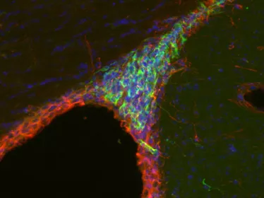 Stem cell neurons - Institut Pasteur