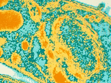 Fiches maladies - Paludisme - Institut Pasteur