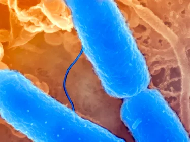 Fiches maladies - Shigellose - Institut Pasteur