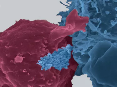 HTV - Institut Pasteur