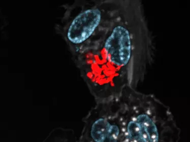 legionella - Institut Pasteur