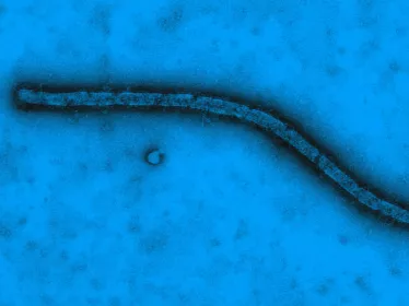 Virus Ebola vu en microscopie électronique à transmission - Institut Pasteur