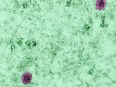  Cellules infectées par le virus du Zika en microscopie électronique à transmission - Institut Pasteur