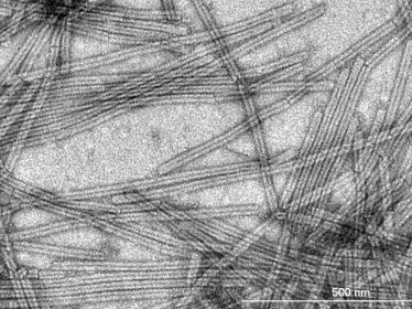 Journal de la Recherche - Un virus issu d’un environnement extrême