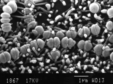 Streptococcus agalactiae - Institut Pasteur