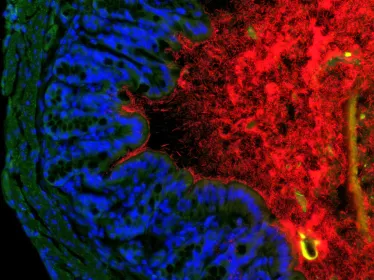 colon souris bacteries - Institut Pasteur