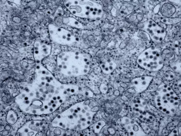 Infection virus Zika - Institut Pasteur