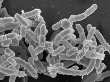 peste plague - Institut Pasteur