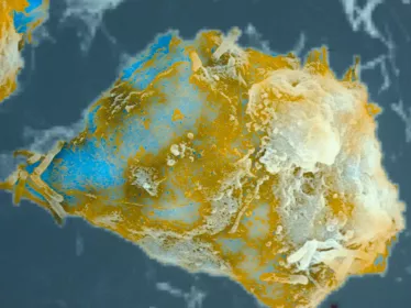 Macrophage phagocytant le bacille du BCG - © Institut Pasteur/Antoinette Ryter