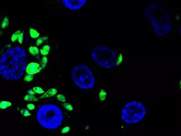 Leishmania : un parasite qui s’adapte à son environnement par amplification chromosomique - Institut Pasteur