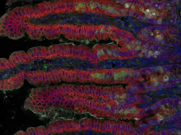 listeria - institut pasteur