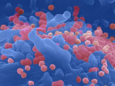 VIH CD4