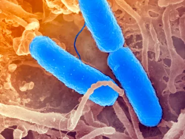 Fiches maladies - Institut Pasteur