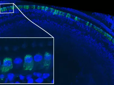 épithélium sensoriel d’une cochlée 