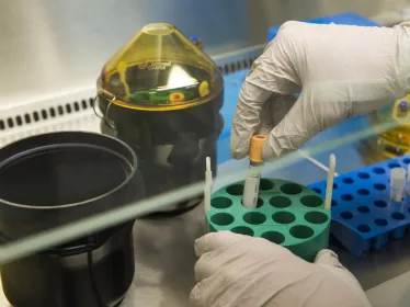 Ebola : 3 variants du virus identifiés en Guinée - Institut Pasteur