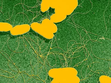 Fièvres typhoïdes - Institut Pasteur