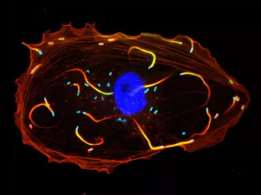 Cellule infectée par Listeria monocytogenes.en microscopie à fluorescence 