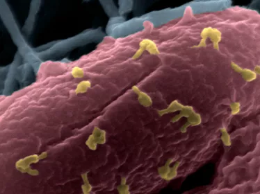 Phagothérapie : les mécanismes d’action fondamentaux décryptés - Institut Pasteur