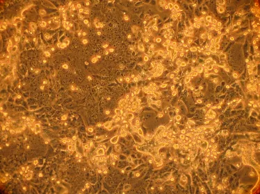 MERS-CoV en Corée du Sud : l’Institut Pasteur est mobilisé
