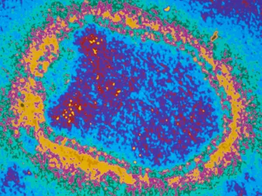 Virus de la rage