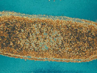 Vibrio cholerae - Institut Pasteur