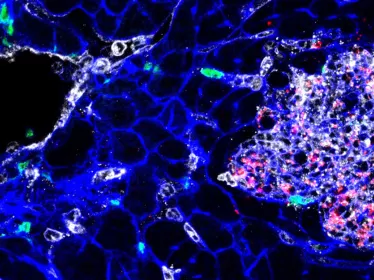 Listeria : des souches hypervirulentes à tropisme cérébral et placentaire - Institut Pasteur