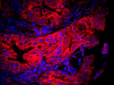 Cancer Initiative at Institut Pasteur