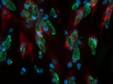 Chlamydia trachomatis - Institut Pasteur
