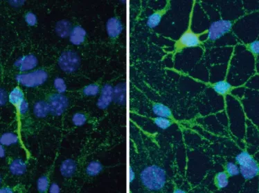 La dépression et l’efficacité des antidépresseurs dépendent de la composition du microbiote intestinal - Institut Pasteur