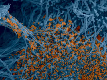 Coronavirus - SARS-CoV-2 - Institut Pasteur