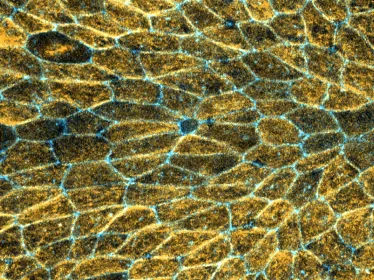 Microtubules - dying cell - Levayer - Villars - Institut Pasteur