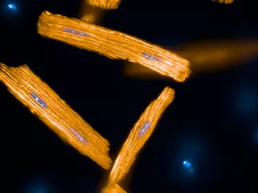 cardiomyocytes de souris en orange, mitochondries en bleu