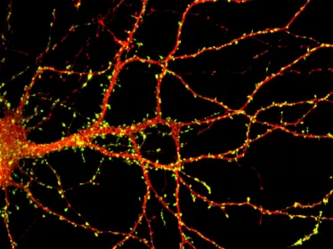 Neurone - Institut Pasteur